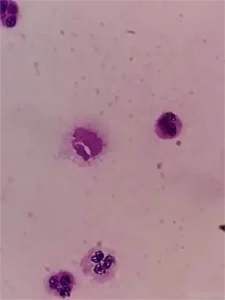 urine sample under the microscope