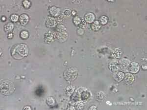 urine leukocyte under the microscope